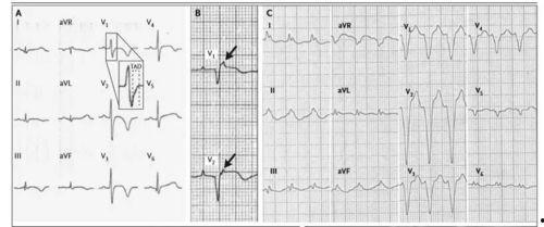 上海心电图视频吃瓜,揭秘瓜界新宠，带你领略瓜界风采